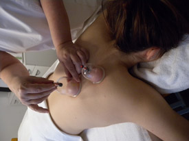 schroepfmassage